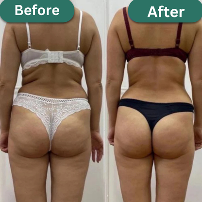 Anti-Cellulite | FIRM & TONE TOOL